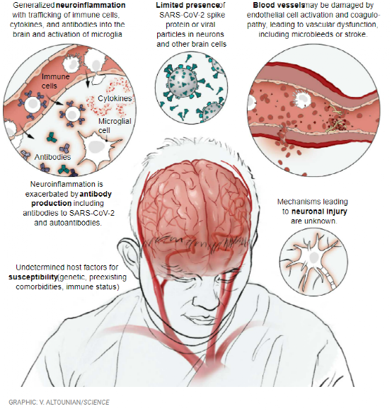 新冠狀病毒是如何損傷腦血管的？新冠病毒會帶來哪些損傷？